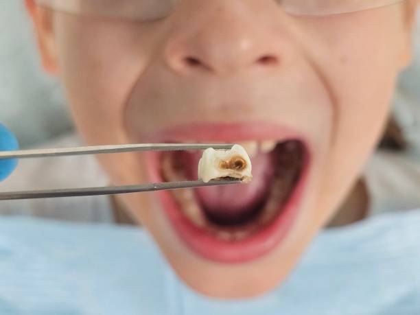 Best Emergency TMJ Treatment in Lockwood, MT